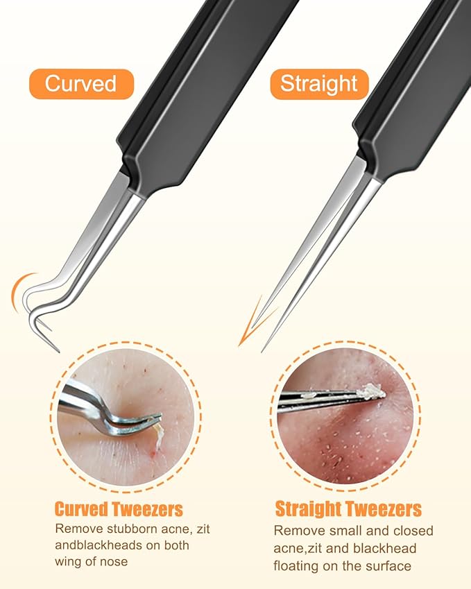 MORGLES Tweezers Set for Men, 10 in 1 Professional Eyebrow Tweezers Kit with Razor, Scissors and Blackhead Remover Tools with Travel Bag, Grooming Beauty Set (Black)
