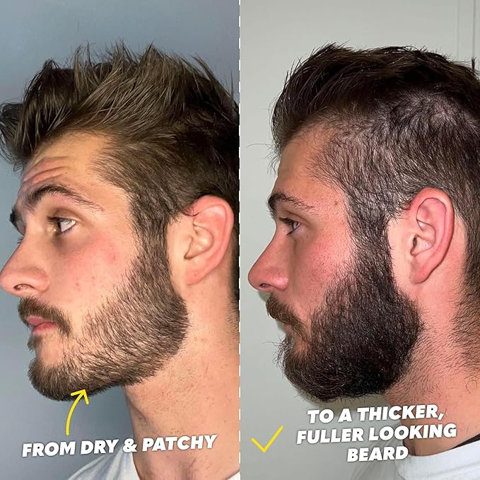 The Beard Club Titanium Beard Growth Kit - Derma Roller, Growth Oil, Vitamins, Vitamin Spray, Biotin Balm, Thickening Conditioner, Shampoo, Straight Razor, Scissors, Comb, Cleansing Spray - Gift Set